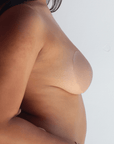 Product shot of Medium tint Silicone Stick-on Bra size B-cup on medium-skinned model, close-up side shot of Silicone Stick-on Bra showing the razor thin edge and natural look without adding extra bulk