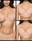 Invisible Lift Inserts