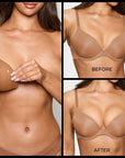 Invisible Lift Inserts
