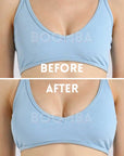 Invisible Lift Inserts